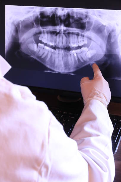Best Knocked-Out Tooth Emergency  in Shaker Heights, OH