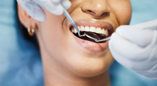 Best Teeth Whitening  in Shaker Heights, OH