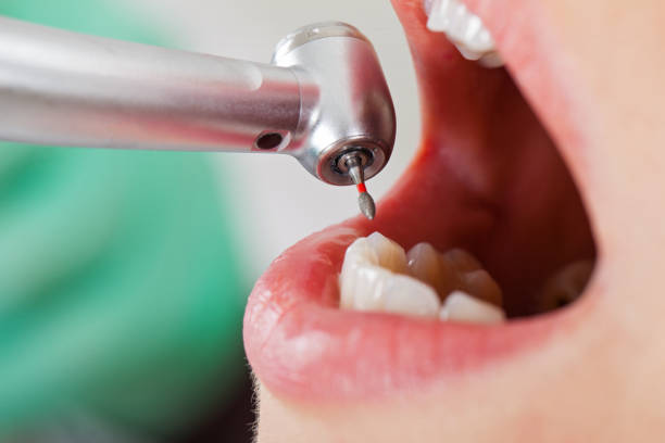 Best Urgent Tooth Repair  in Shaker Heights, OH